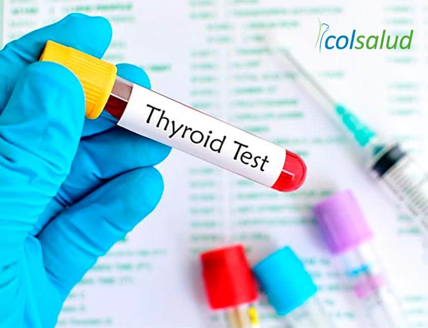 10 señales que te harán sospechar si tienes hipotiroidismo